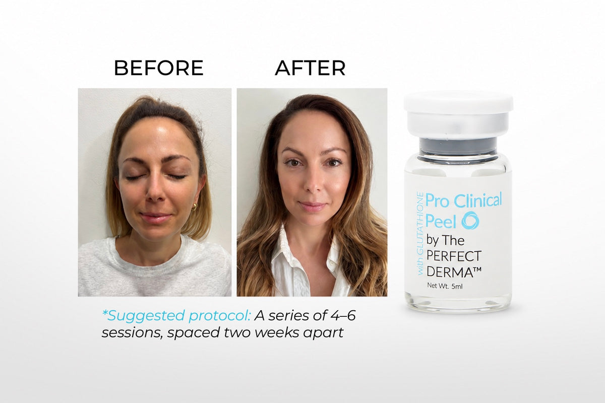 PRO CLINICAL PEEL with GLUTATHIONE