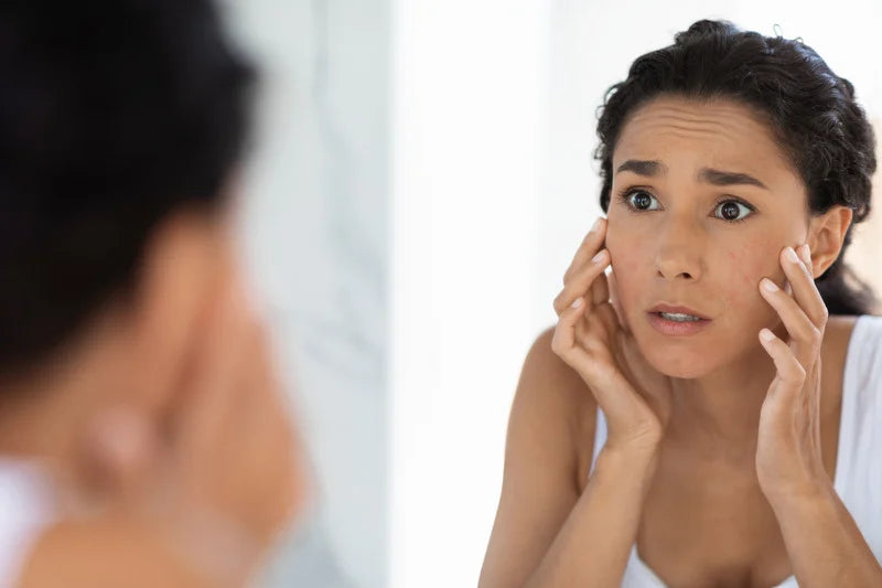 5 SIGNS YOU'RE READY FOR YOUR 1ST PERFECT DERMA™ CHEMICAL PEEL TREATMENT